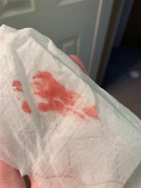 This evening I mostly filled a thong pad with bright red blood. . Bright red bleeding 6 weeks postpartum reddit